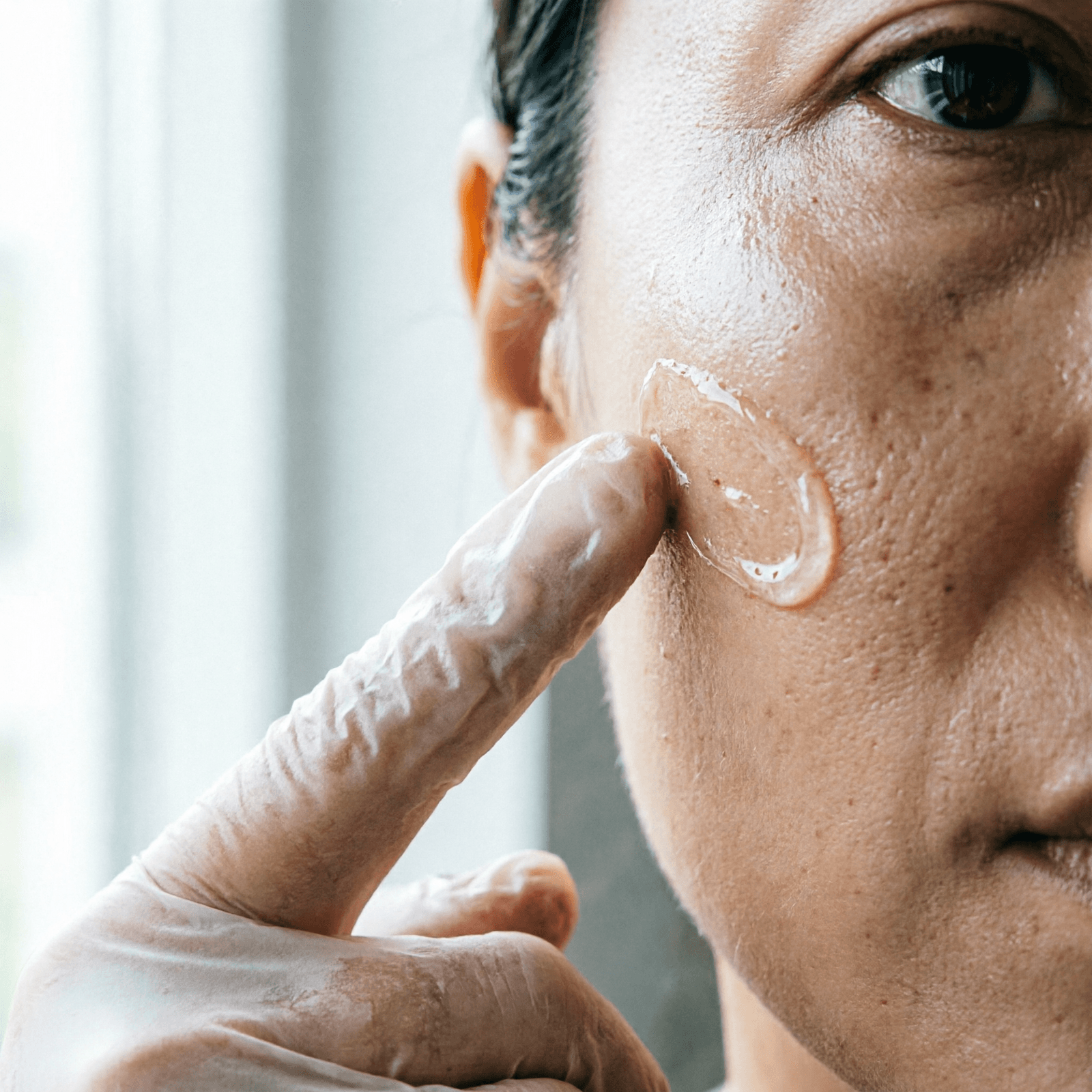 B-Tox Peel